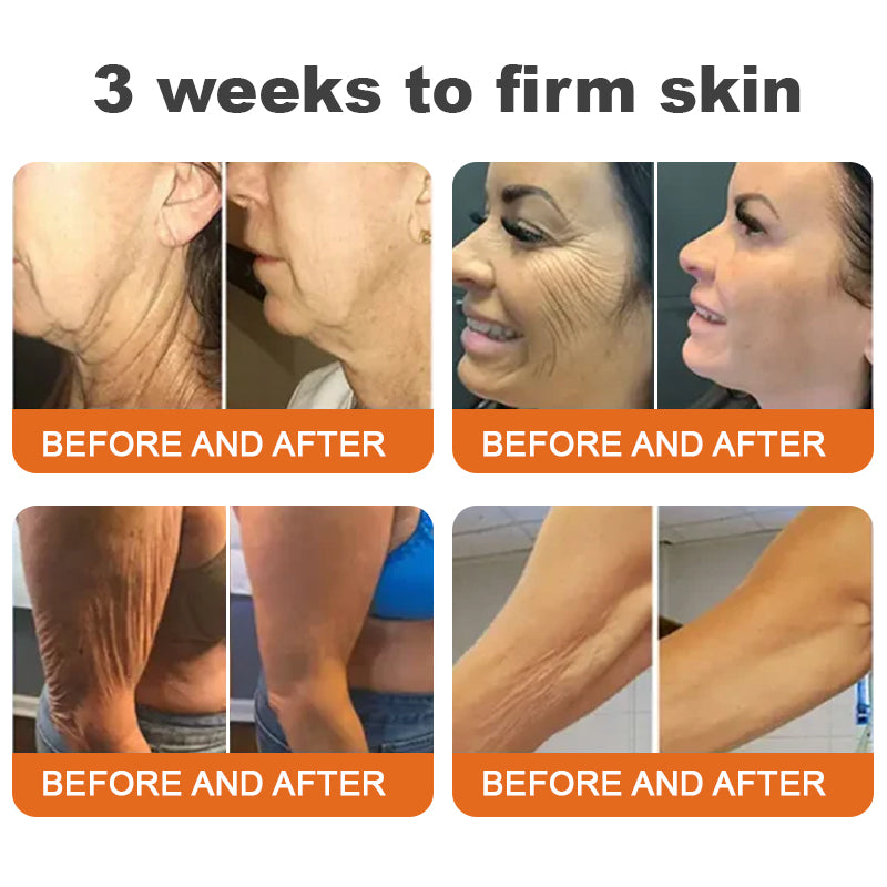 (🙏🌿Made and Shipped from Canada👨⚕️)✨Flysmus™ Botox Bee Venom Firming Serum Stick🔥LAST DAY 70% OFF