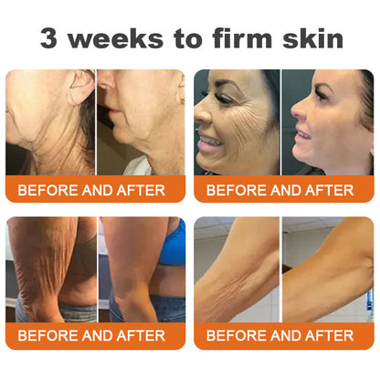(🙏🌿Made and Shipped from Canada👨‍⚕️)✨Flysmus™ Botox Bee Venom Firming Serum Stick🔥LAST DAY 70% OFF