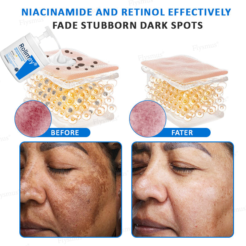✨✨💧(Made and Shipped from Canada)✨Rolimey® Advanced Firming & Wrinkle-Reducing Cream (with SPF 50+)✨LAST DAY 60% OFF