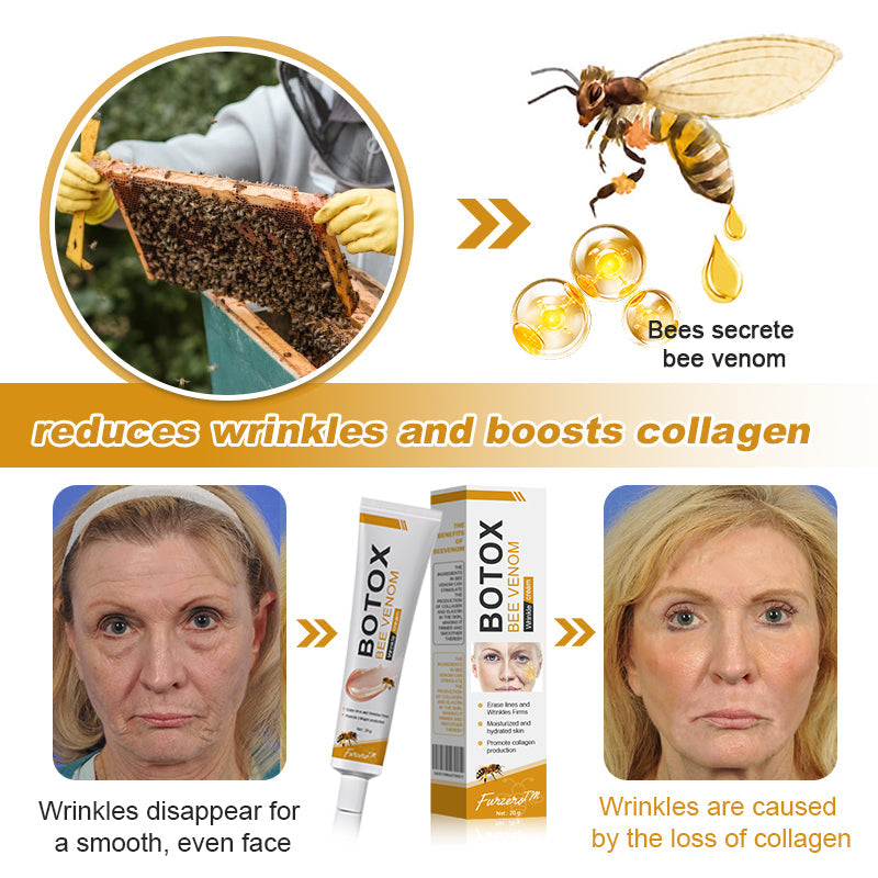 (🐝💧 Made and shipped from Canada👨‍⚕️) Furzero™ Botox Bee Venom Wrinkle Removal Cream- LAST DAY 70% OFF