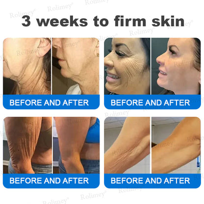✨✨💧(Made and Shipped from Canada)✨Rolimey® Advanced Firming & Wrinkle-Reducing Cream (with SPF 50+)✨LAST DAY 60% OFF