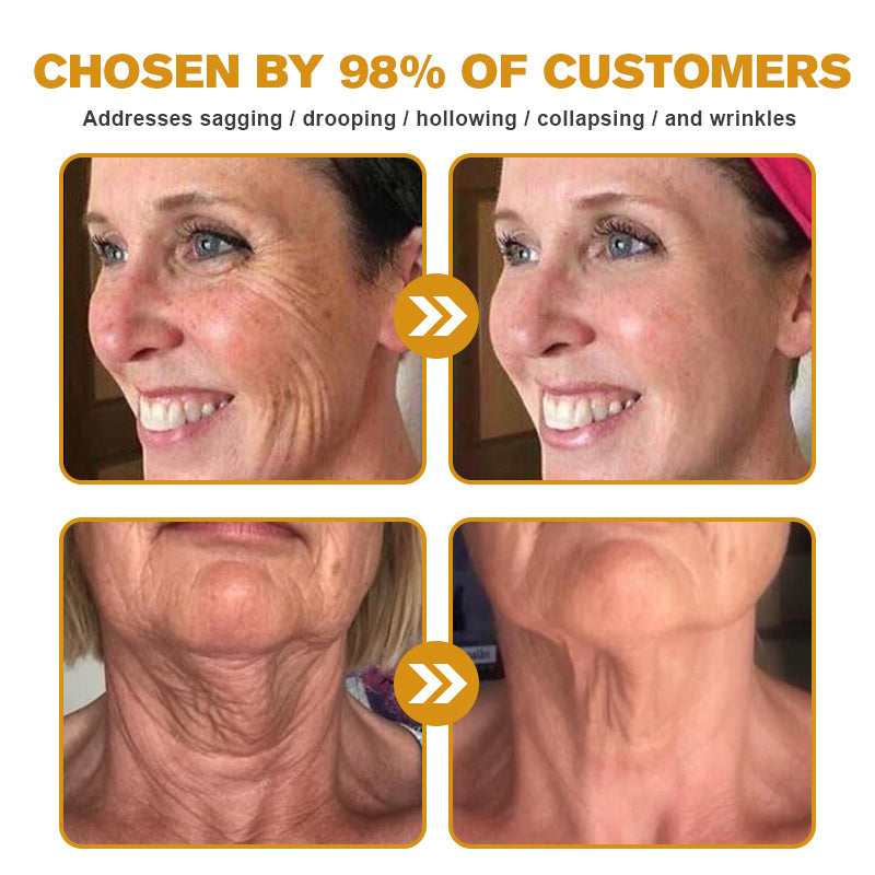 (🐝💧 Made and shipped from Canada👨‍⚕️) Furzero™ Botox Bee Venom Wrinkle Removal Cream- LAST DAY 70% OFF