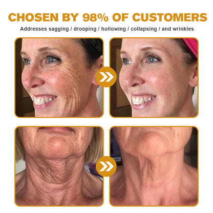 (🐝💧 Made and shipped from Canada👨‍⚕️) Furzero™ Botox Bee Venom Wrinkle Removal Cream- LAST DAY 70% OFF