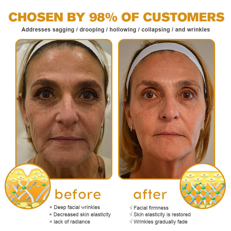 (🐝💧 Made and shipped from Canada👨‍⚕️) Furzero™ Botox Bee Venom Wrinkle Removal Cream- LAST DAY 70% OFF